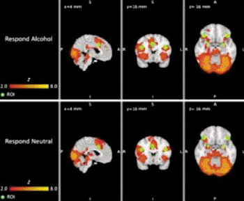Image: Brain regions of interest (green) and group-level brain activity (red-yellow); data were averaged across three fMRI sessions and overlaid on a standard brain template (Photo courtesy of Penn State).